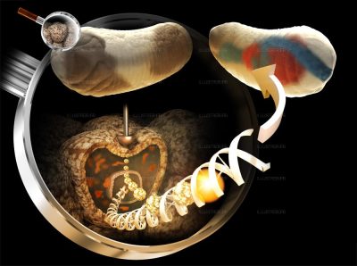 Pour la Science. La mécanosensibilité des gènes 1